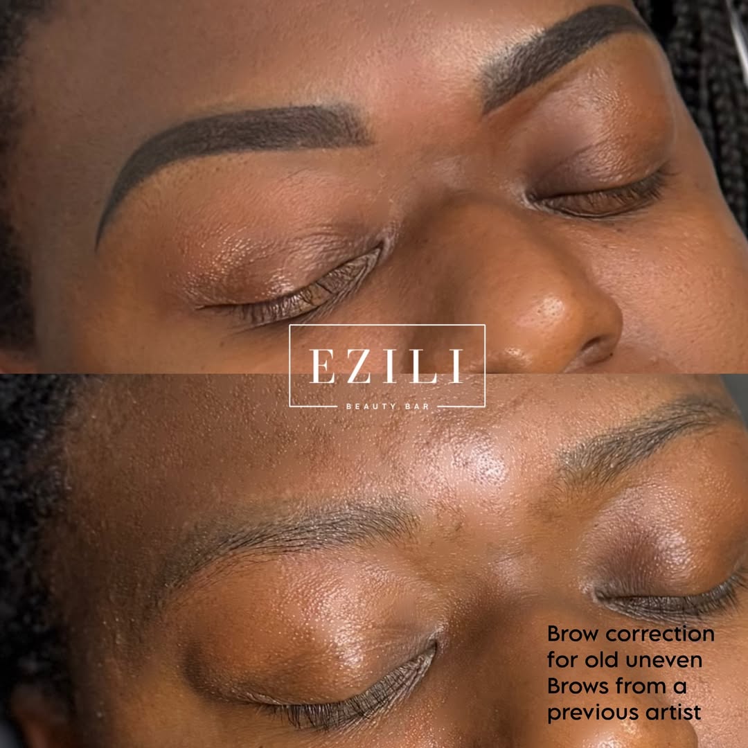 Brow correction for uneven brows